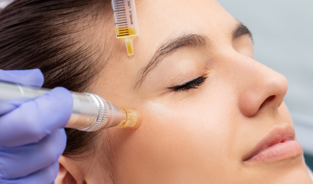Microneedling