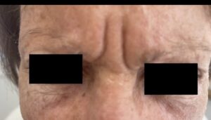 before-300x